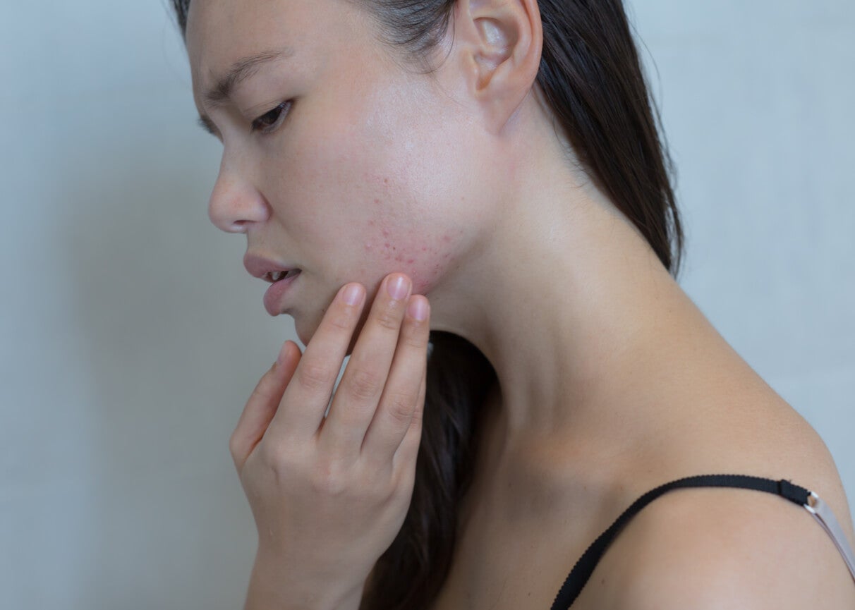 Mujer con manchas en la cara